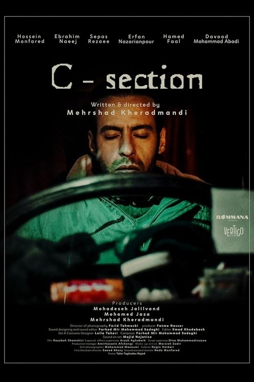 C-Section سزارین