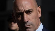 ES - Rubiales vs Hermoso: El beso de la Copa del Mundo (2025) (GB)
