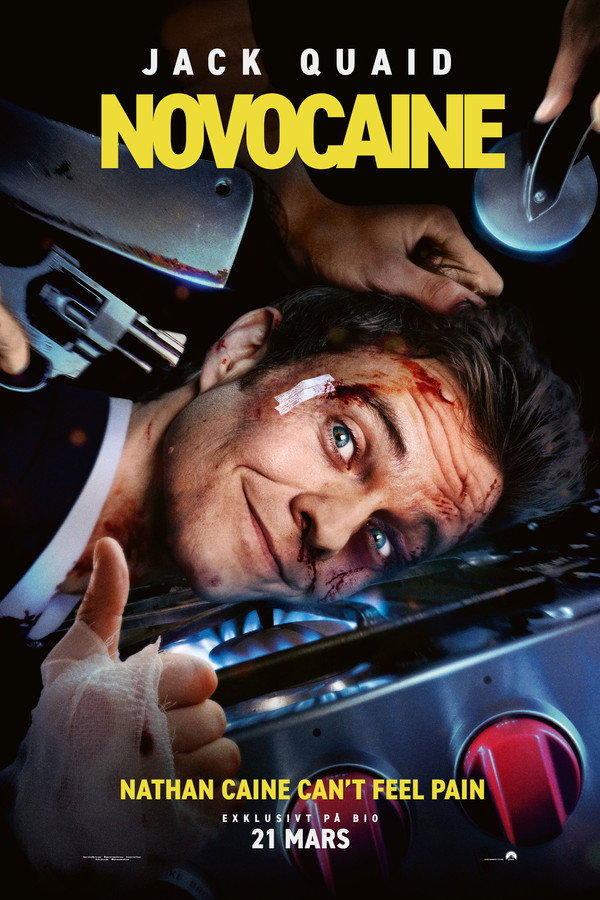 SE - Novocaine