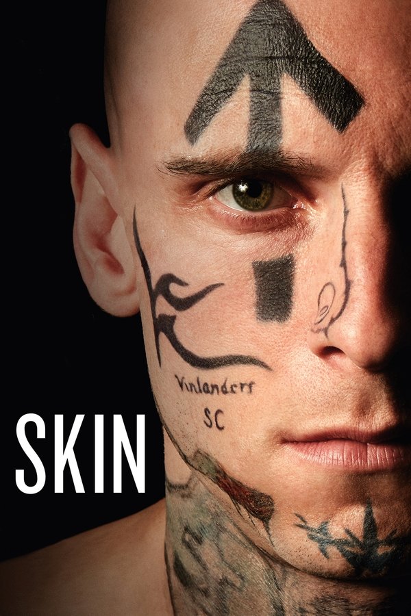 SE - Skin